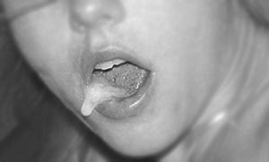 Fellation :éjaculation dans la bouche