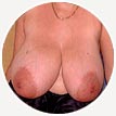 Femme grosse poitrine à Nice