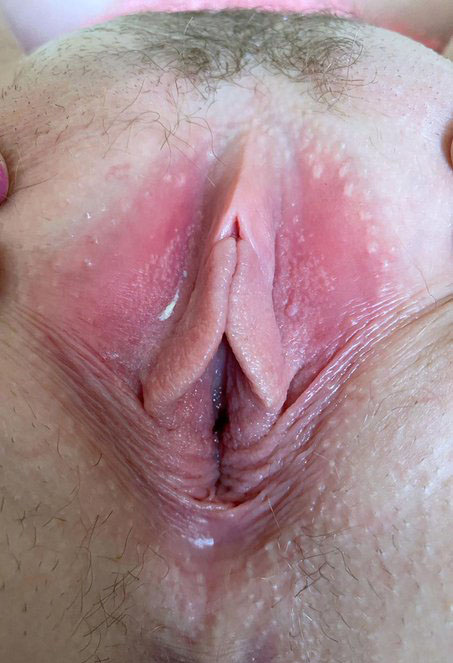 Beau et gros clito