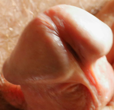 énorme gland