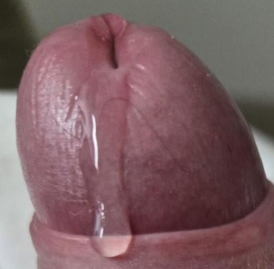 gros gland qui coule