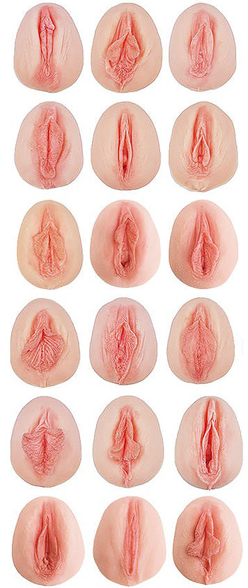 formes vulvaires