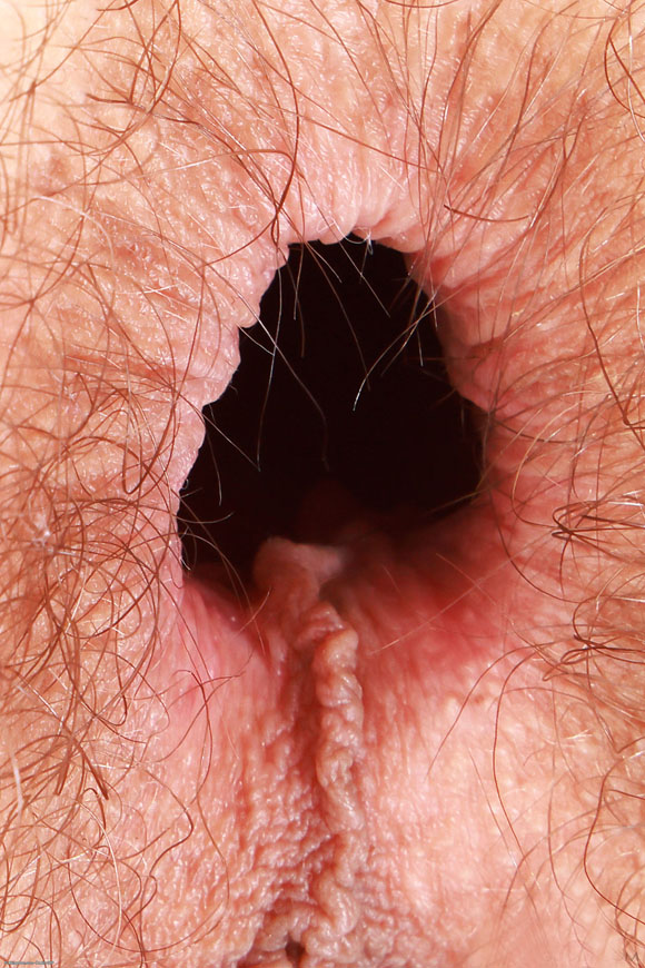 anus ouvert